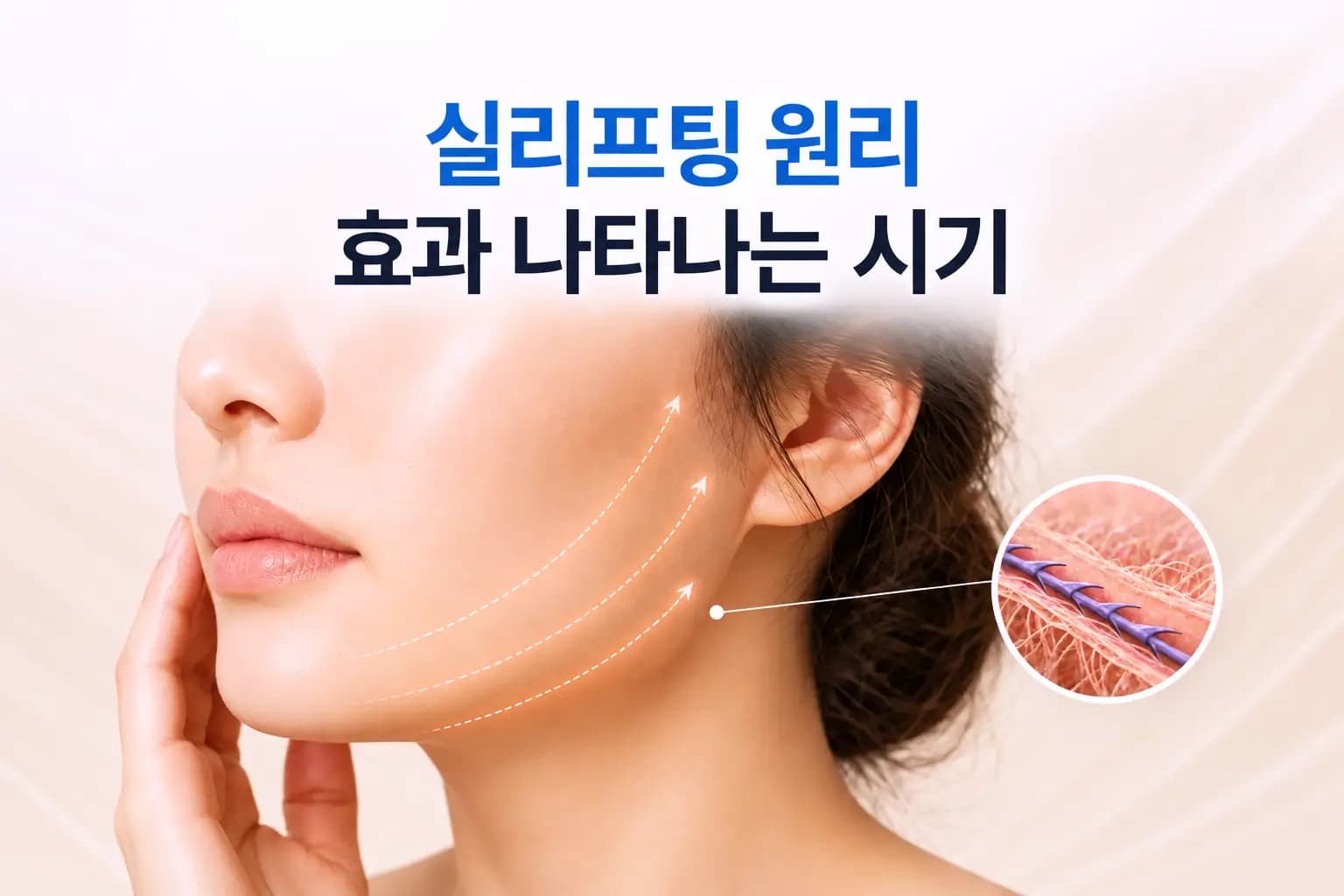 턱선 피부 아래 돌기 실 경로와 실 주변 콜라겐 생성 확대 컷을 담은 실리프팅 원리 썸네일